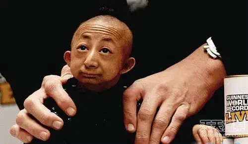 最小人只有9斤 盘点世界上的袖珍小人