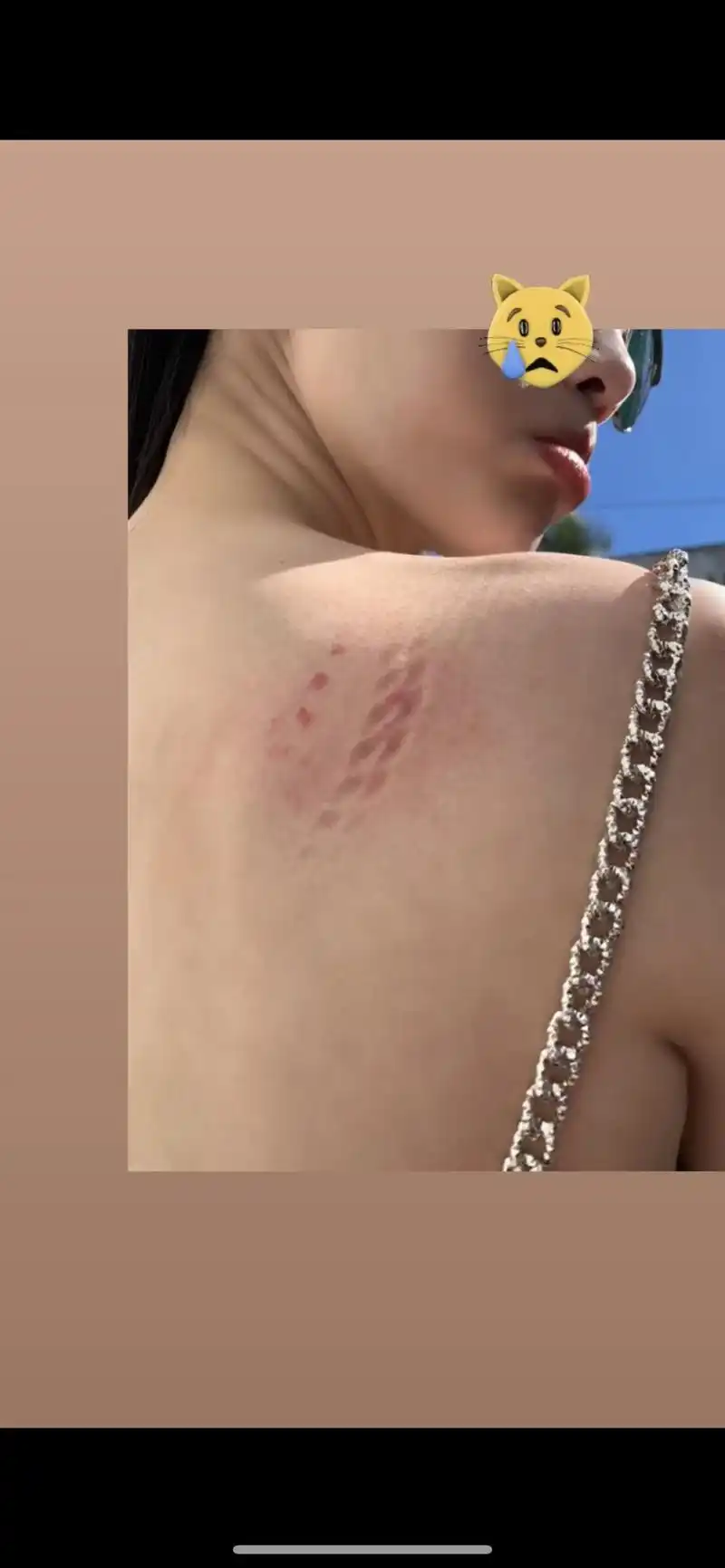 后背伤痕照,照片中,奚梦瑶正在进行广告拍摄,她的后背被铁链勒出印子