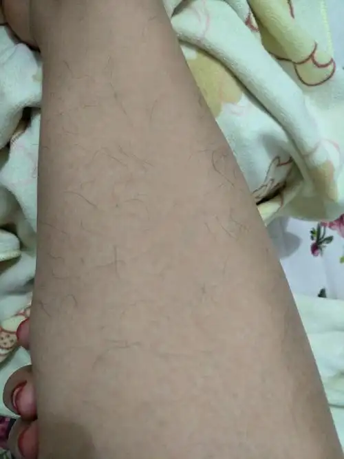女生腿毛旺盛是怎样的人生体验