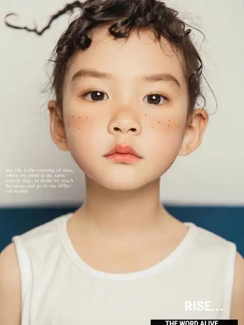 潮萌小宝贝实现雀斑自由03儿童照