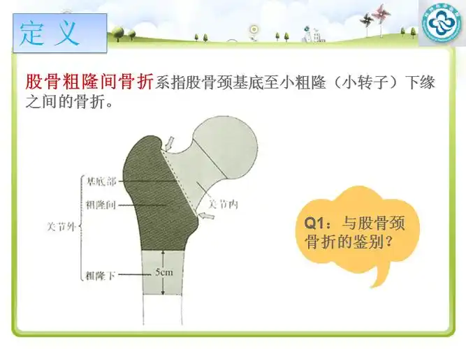 左股骨粗隆间骨折护理查房ppt