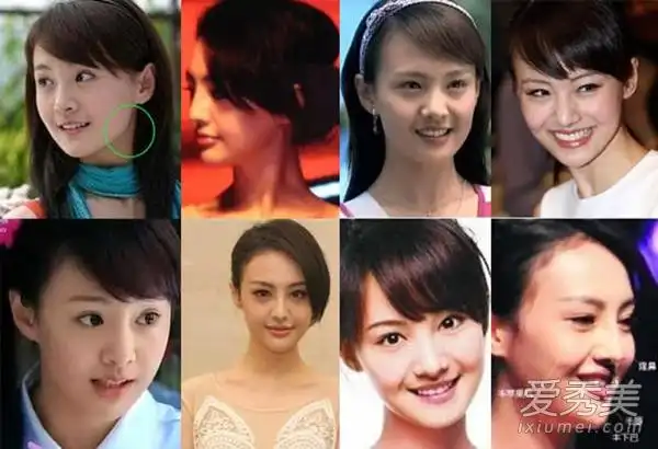 郑爽出道6年容貌变化 二次整容下巴翘上天(图)