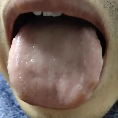 这10个关于舌头的小问题,竟然可以反应出如此多的健康秘密