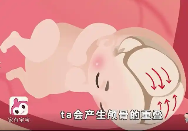 宝宝在妈妈的肚子发生什么了,刚出生来的头扁扁的