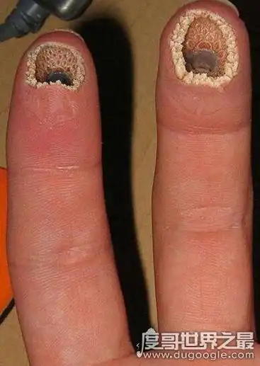 密集恐惧症测试图恶心,密集恐惧症大揭秘