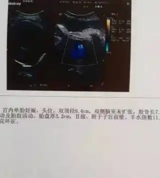 目前记得就这些啦八男孩养老子女孩养妈,我怀孕的时候老公变胖好多.