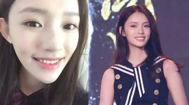 杨颖承认龅牙时很丑,杨幂代言牙膏,唐嫣最逆袭!_林允_造型_牙齿