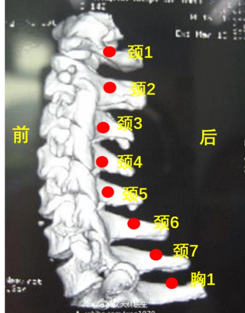 颈椎病_介绍_日常注意事项 - 好大夫在线