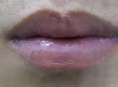 嘴唇可以告诉你的9个早期健康信号,值得收藏