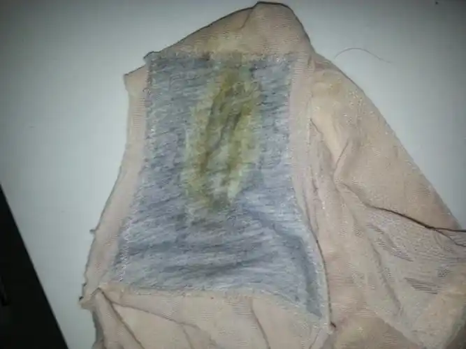 女孩子三角上这样情况怎么回事呢