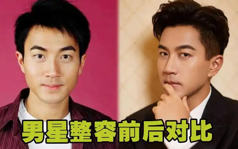 男星整容前后对比,黄晓明差别大,刘恺威脱胎换骨,而他越整越残