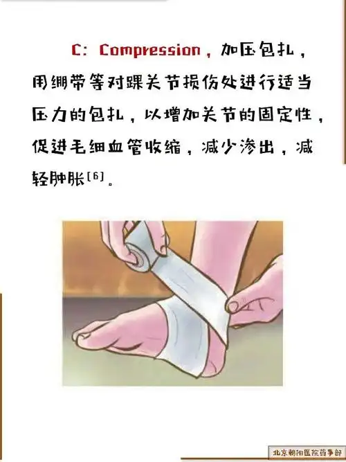 崴脚别硬撑police式处理更有效