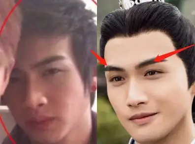 小眼睛,蒜头鼻,下巴后缩是怎么整成当红小生的_张彬彬