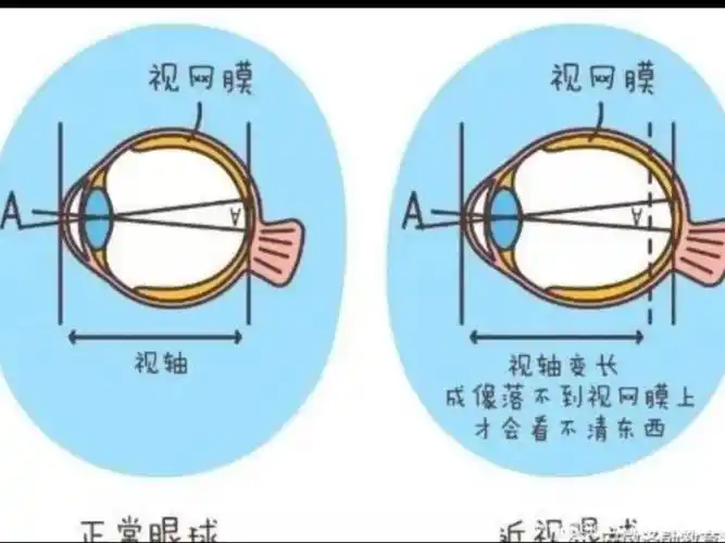 每天带娃去户外溜达2小时,是保护宝宝视力的关键.