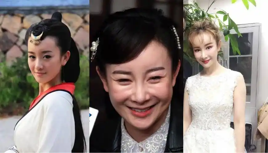 盘点娱乐圈整容后毁容的女明星,李小璐不算最惨