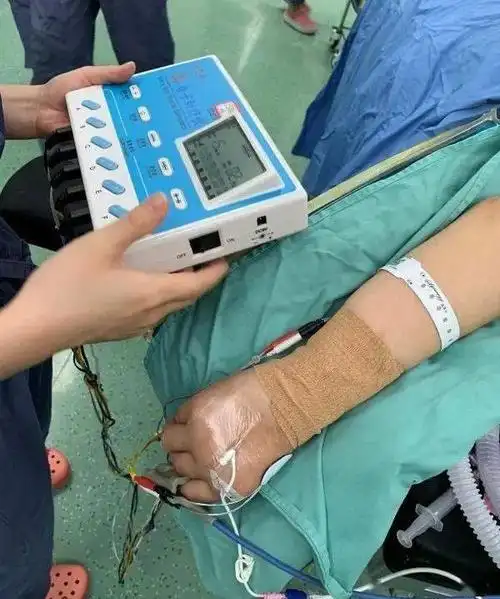 创新自主呼吸针刺复合麻醉胸腔镜气管恶性肿瘤切除