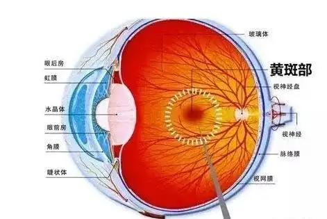 为什么说近视600度是一个很大的分水岭?