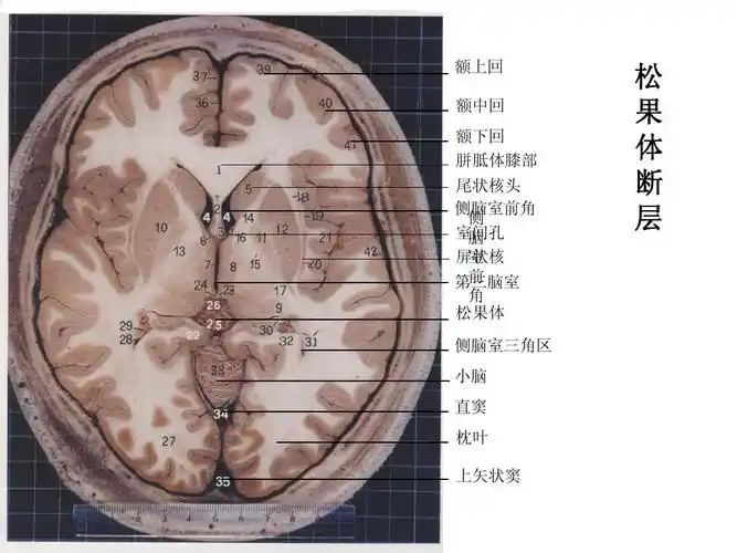 详细 上一页第6页 下一页 你可能喜欢 颅脑断层解剖 腹部断层解剖