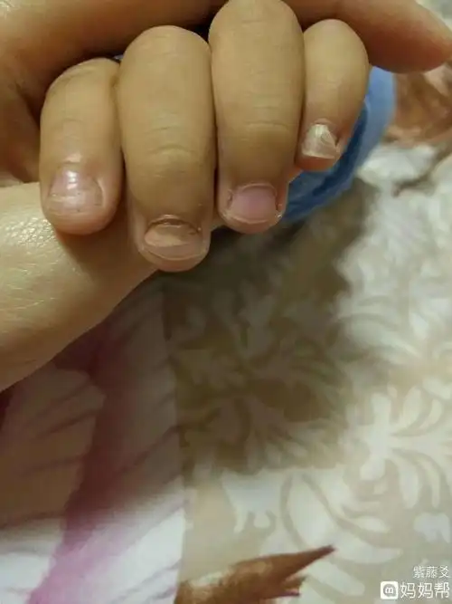 宝宝缺维生素指甲图片,自从二胎放开,接娃放学的就不仅仅是父母,老人