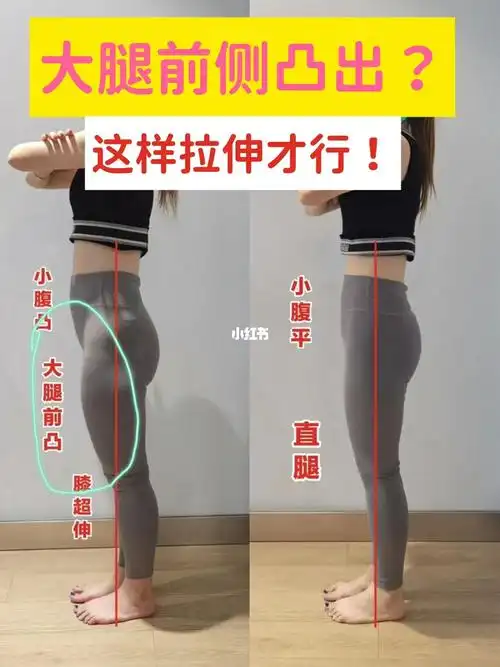 大腿前侧凸出这样拉伸才行