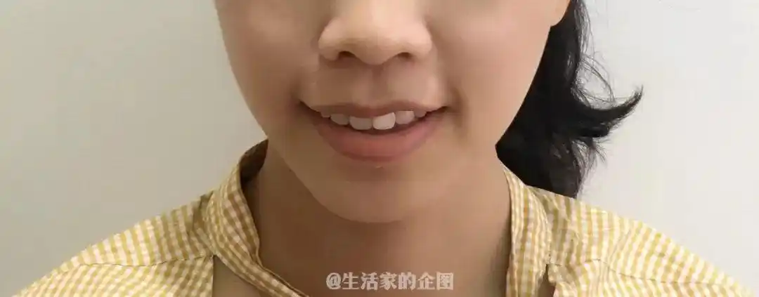 隐形牙套,透明的牙齿套,直接套在牙齿上即可,最大优点是美观,如果不是