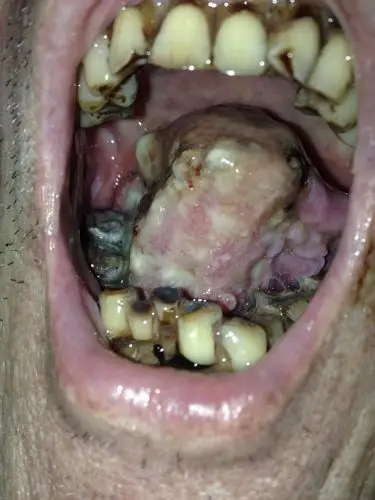 各位医生专家们大家好!