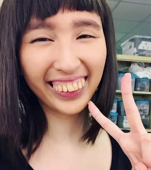 黄智贤主演的时装剧《波士早晨》里演一位龅牙丑女