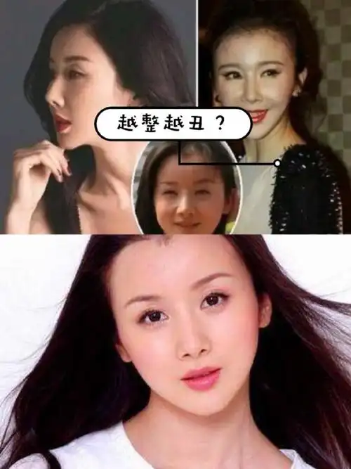 孙菲菲是如何从第一古典美女变成了整容狂