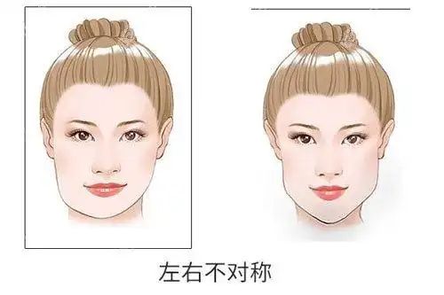 那就请小伙伴们对着镜子,牙齿无法正常咬合或者面部中轴线有明显偏离