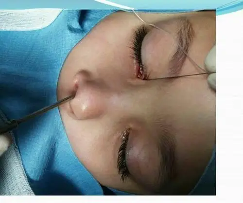 儿童常见眼病的诊治 ————上海市儿童医院 乔彤