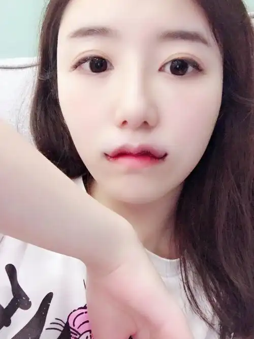 m唇综合一招解决】