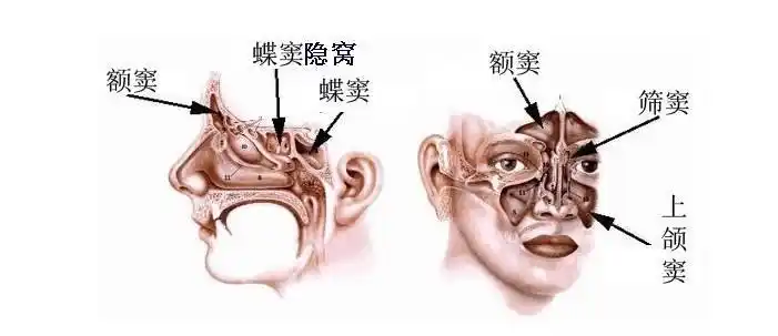 现代生活要警惕霉菌性上颌窦炎