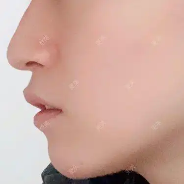 正面看还行侧面看嘴唇那里特丑但是整个侧颜不好看