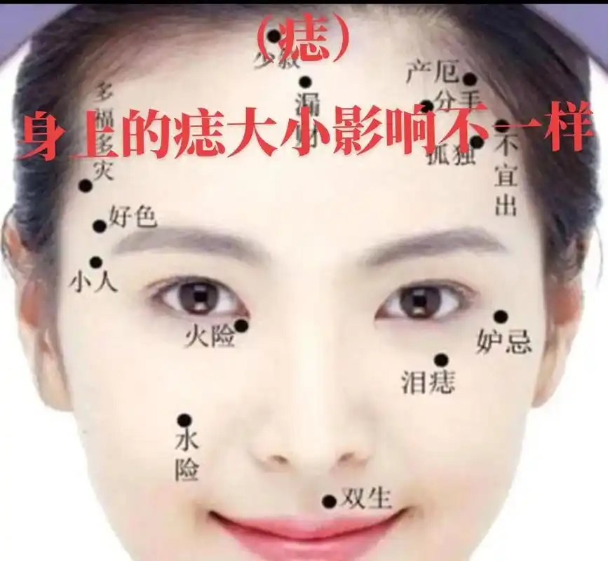 身体上不同形状,色泽的痣会影响运势!