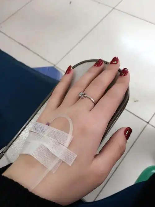 昨天打针搞成这样,今天下这大的雨该怎么去打针哦