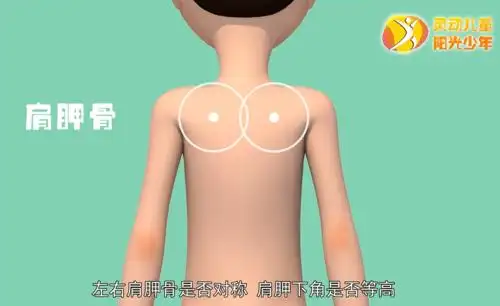 家长们注意了孩子高低肩坐姿不正应警惕这病这里有份防治指南