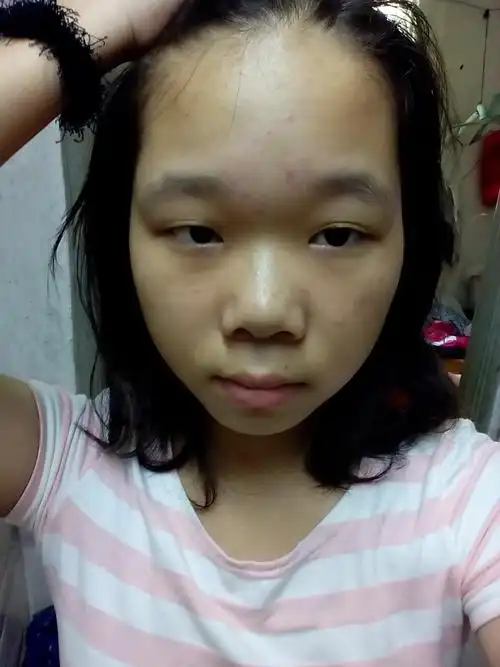 昨天没睡好 追答: 我要看五官照,就是完整的头部照片.