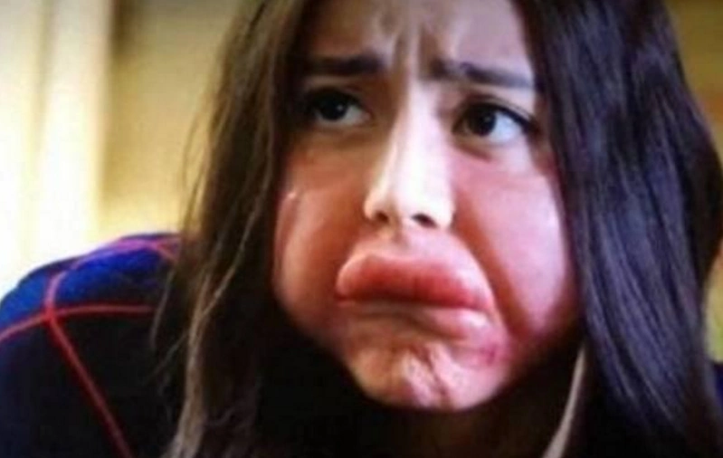 娱乐圈6大扮丑女星,赵丽颖销魂,苑琼丹腊肠嘴,图6让人心疼!