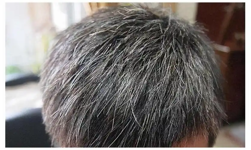 有些人年纪轻轻,才三四十岁了白头发,这4种营养素关键!-爱慕生活网