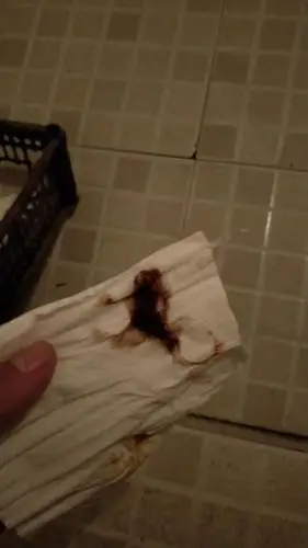 这是我排出来的黑乎乎的,很粘稠,不知道是什么,一开始以为是月经没完