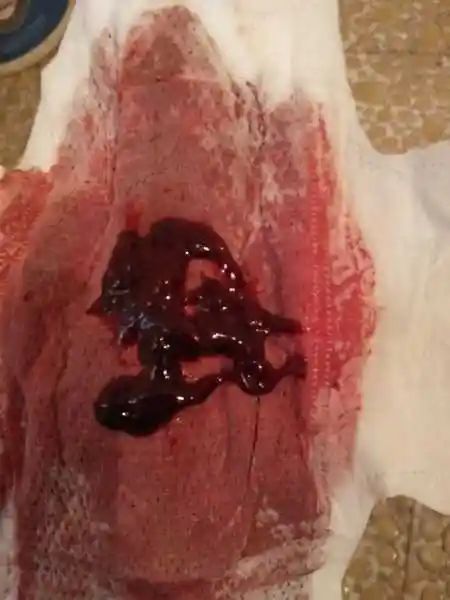 来月经有血块是什么原因