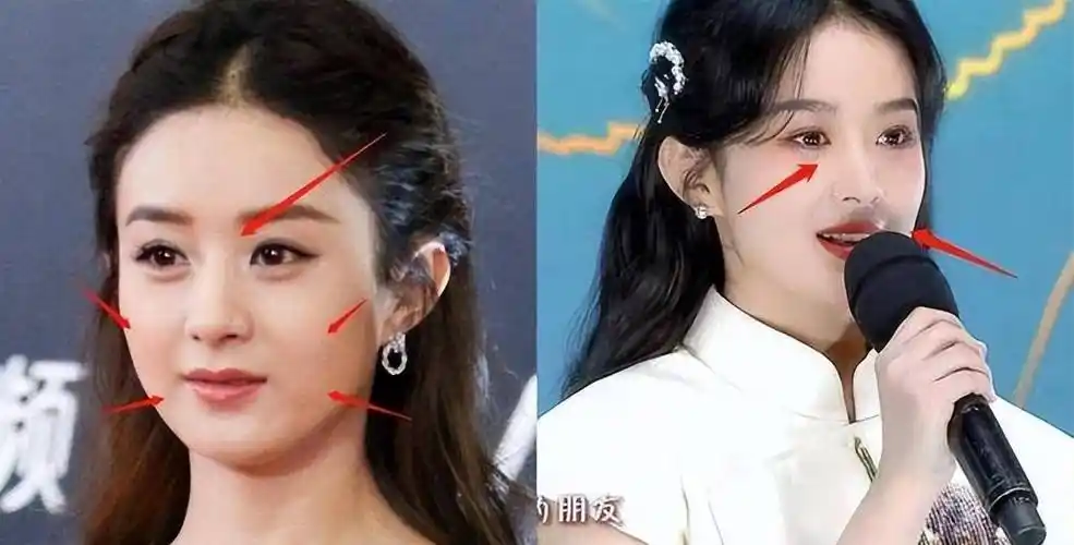 原创赵丽颖整容11年前综艺旧照被找出和现在对比变化一目了然