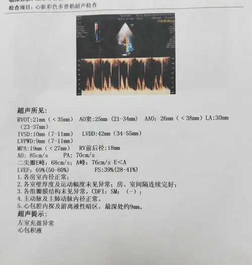 求助一下母亲复查因美尼尔症状心脏彩超心包积液