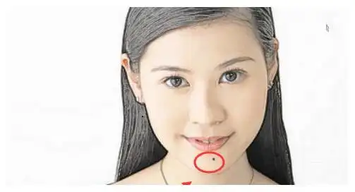 有活痣的人,天生显贵,在事业上有非常不错的个人发展才能,有贵人相助