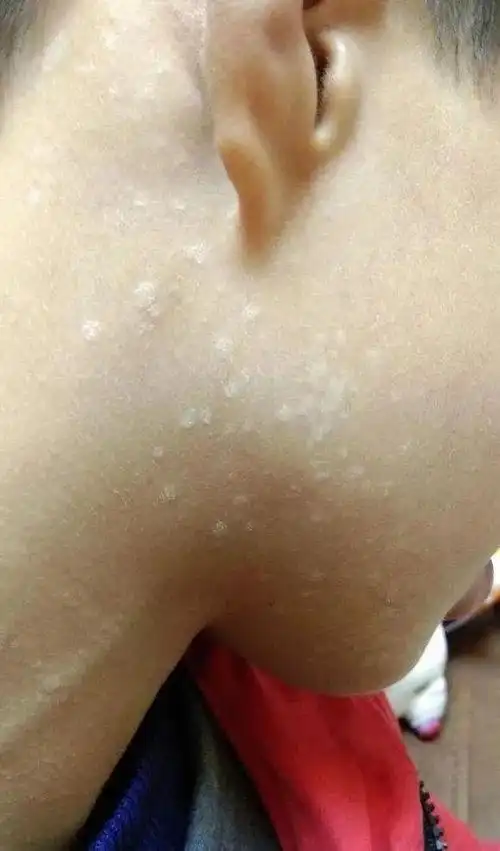 孩子常见的健康问题答疑