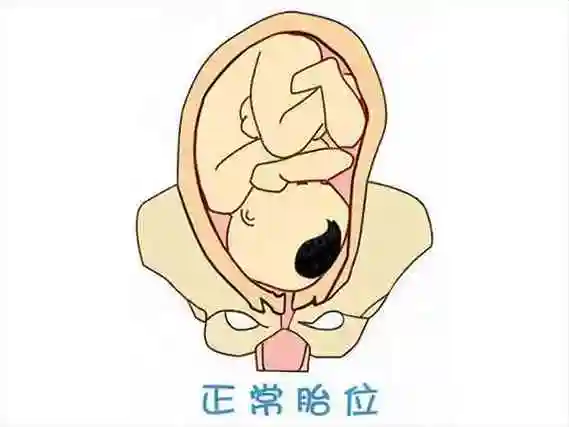 朋友说胎儿头位容易看孩子,具体怎么看?-求医试管网