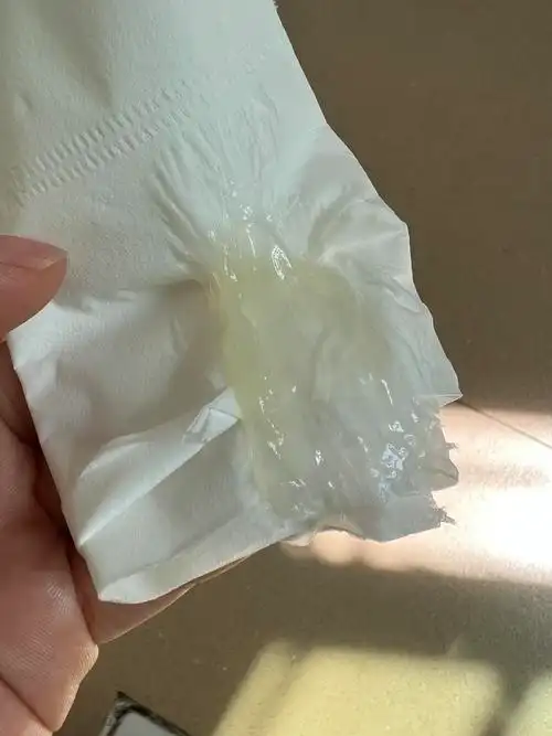 姊妹们我排卵期的白带有一点发黄这正常吗