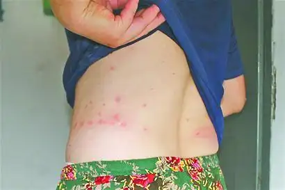 大连某小区一居民家养狗生跳蚤 全楼居民遭殃被咬毁了