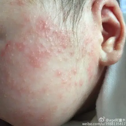 要怎么处理?(图)