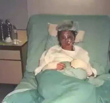 1989年,胡慧中在三楼被炸烧成火人后,从此踏上被"放纵"不归路_因为